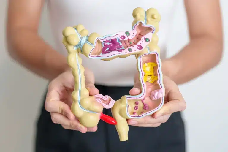 femme qui tient un schéma d'un intestin en 3d